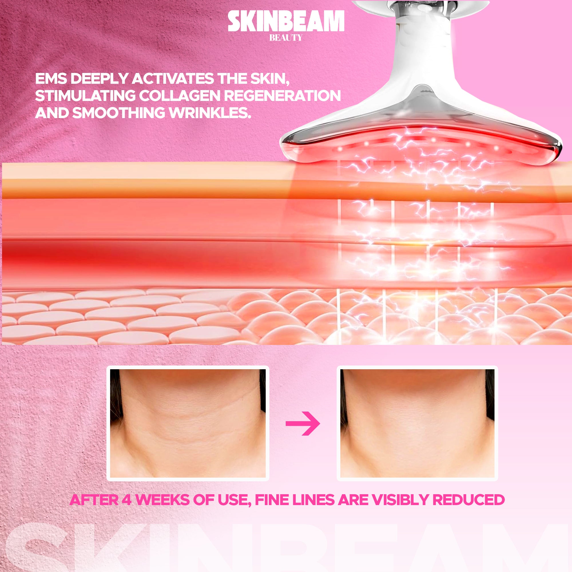 Skin Beam EMS Thermal Neck Lifting and Tightening Massager – Advanced Microcurrent Wrinkle Remover