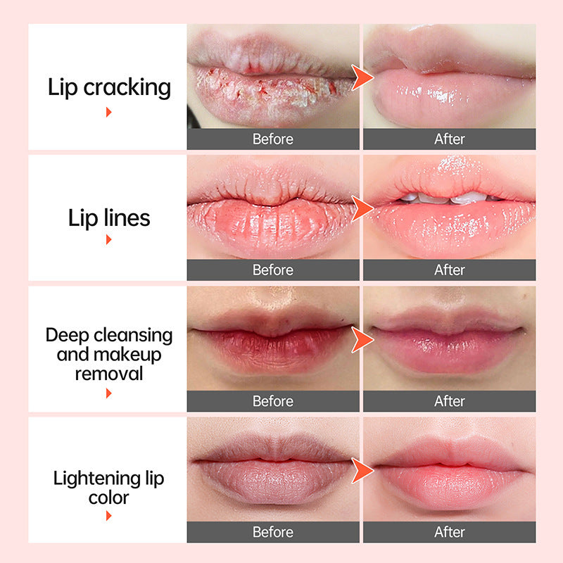 Anti-Cracking & Dry Lips Nourishing Moisturizing Lip Care Lip Balm – Hydrating & Repairing Lip Treatment for Soft, Smooth Lips