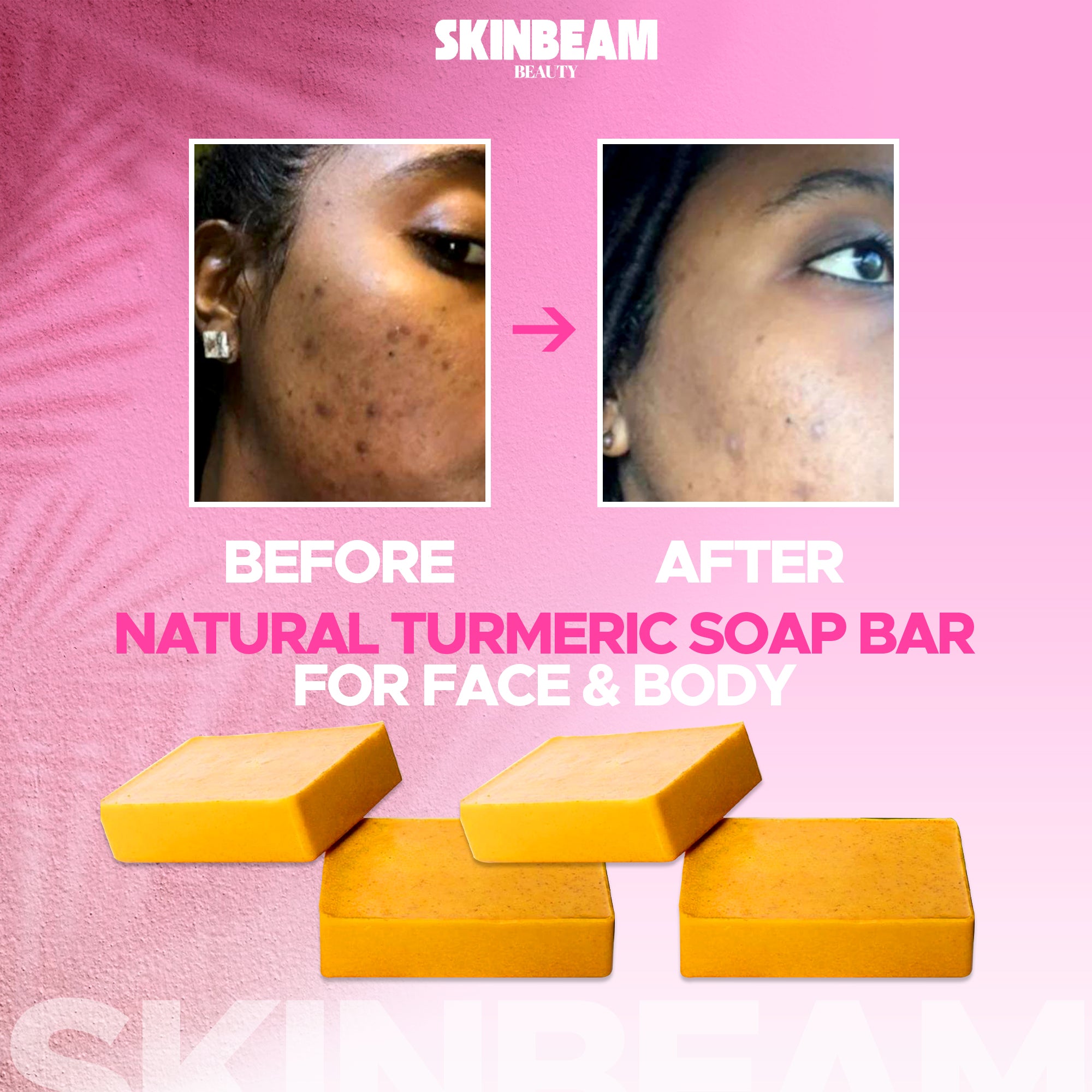 Turmeric Soap, Lemon Soap, Kojic Acid Soap – Hyperpigmentation & Dark Spot Brightening Soap Bar
