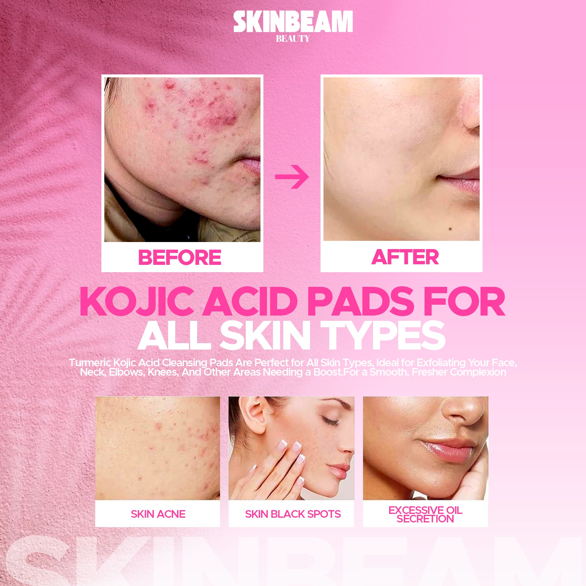 Lemon Turmeric & Kojic Acid Pads – Exfoliating & Brightening Facial Pads for Dark Spots, Acne, and Uneven Skin Tone